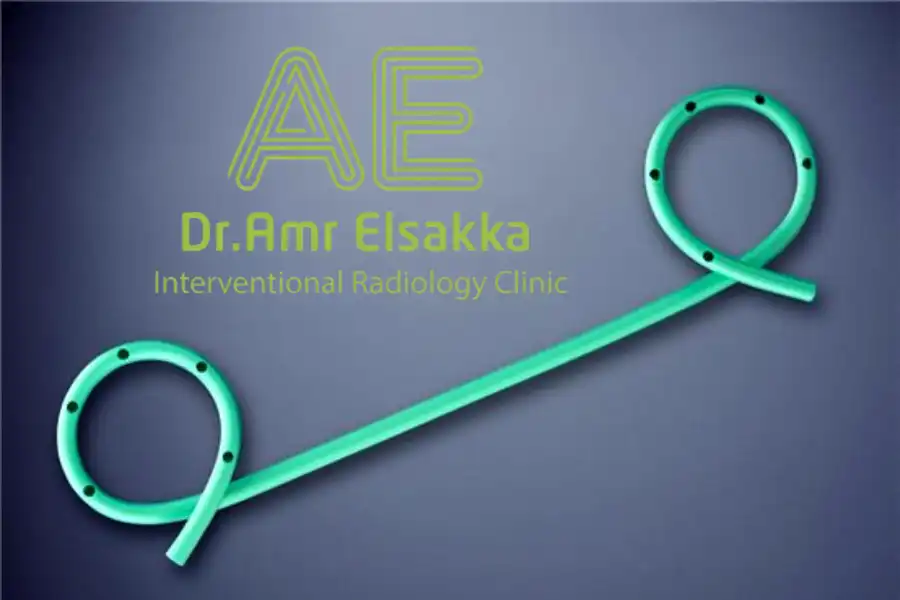 شكل دعامة القناة المرارية البلاستيك