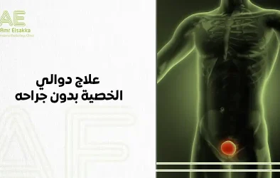 علاج دوالي الخصيه بدون جراحه
