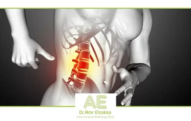 علاج عرق النسا بالتردد الحراري