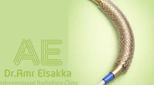 شكل دعامة القناة المرارية 