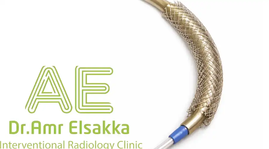 شكل دعامة القناة المرارية